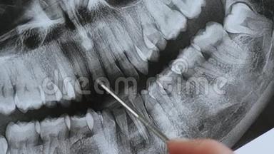颌骨特写的全景断层扫描。 正畸医生分析咬合进行牙科治疗..